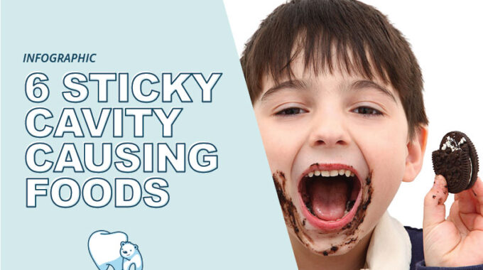 sticky cavity causing foods