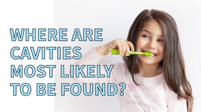 where are cavities likely to be found