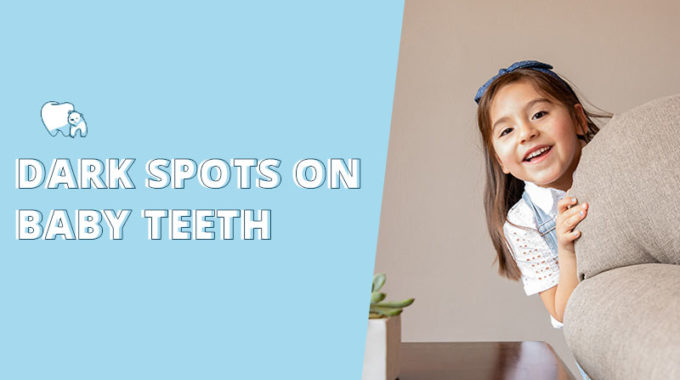 dark spots on baby teeth